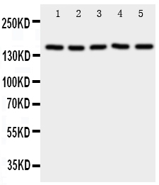 1 - Anti-RFC1 Antibody ABO11026