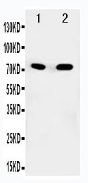 1 - Anti-SDHA Antibody ABO11027