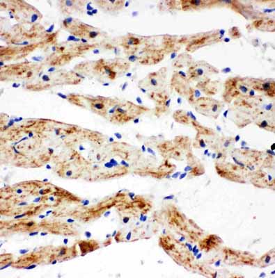 2 - Anti-SDHB Antibody ABO11028