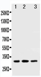 1 - Anti-SDHB Antibody ABO11028