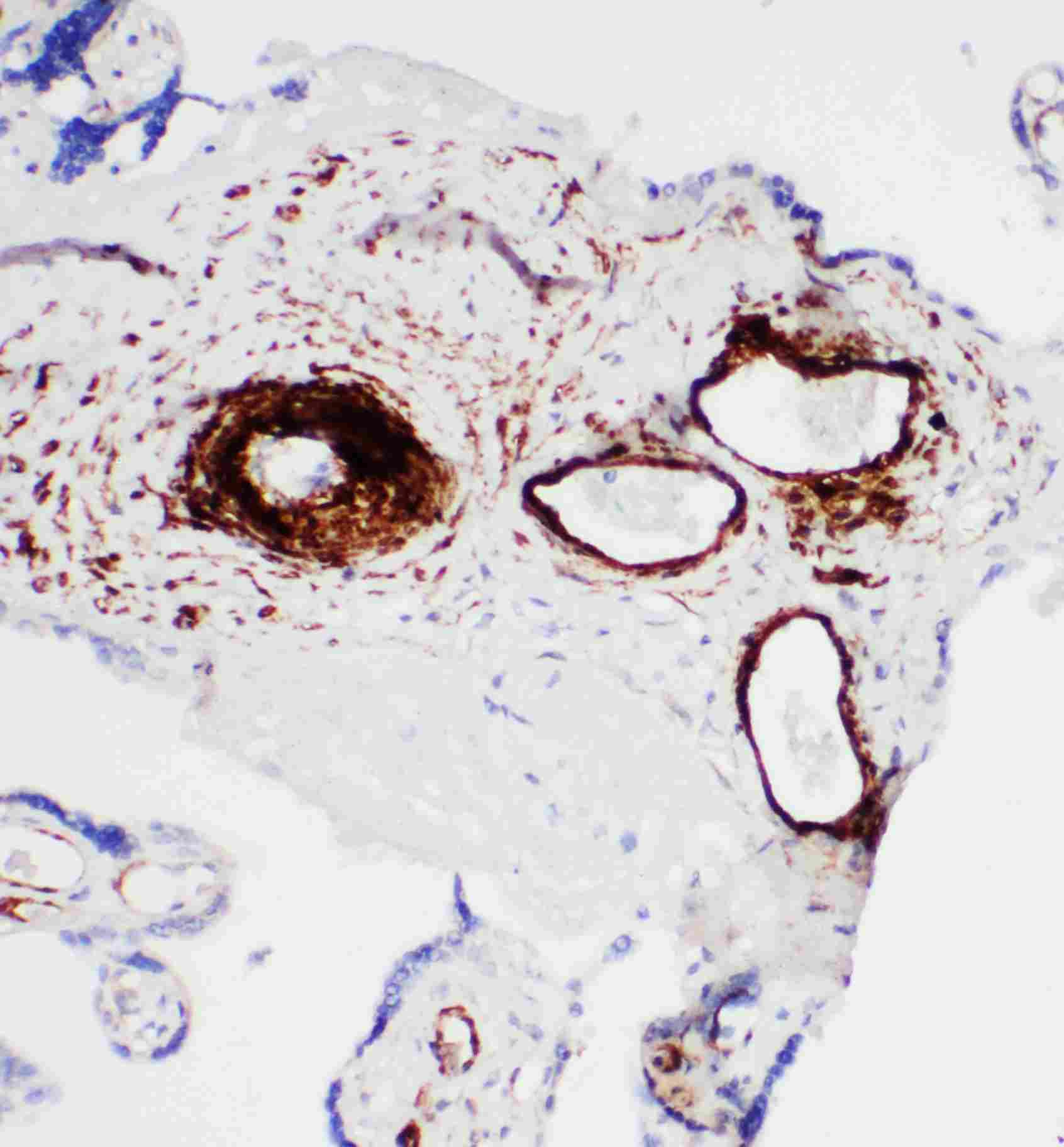2 - Anti-SERCA1 ATPase Antibody ABO11029