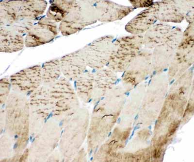 2 - Anti-SERCA1 ATPase Antibody ABO11029