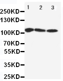 1 - Anti-SERCA1 ATPase Antibody ABO11029
