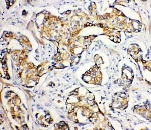 2 - Anti-SERCA2 ATPase Antibody ABO11030