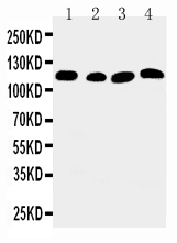 1 - Anti-SERCA2 ATPase Antibody ABO11030