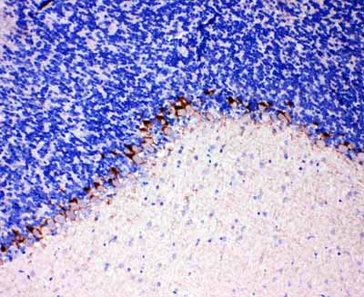 2 - Anti-GABA Transporter 1/GAT 1 Antibody ABO11031