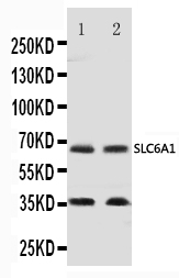 1 - Anti-GABA Transporter 1/GAT 1 Antibody ABO11031
