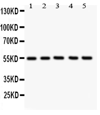 1 - Anti-GLUT4 Antibody ABO11032