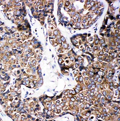 2 - Anti-ABCB6 Antibody ABO11033