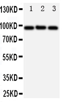 1 - Anti-ABCB6 Antibody ABO11033