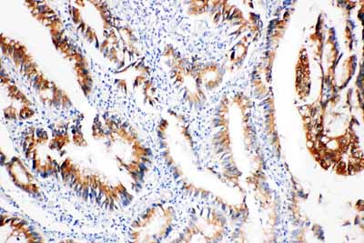 2 - Anti-COX2/Cyclooxygenase 2 Antibody ABO11034