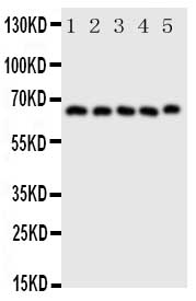 1 - Anti-COX2/Cyclooxygenase 2 Antibody ABO11034