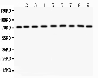 1 - Anti-GHR Antibody ABO11035