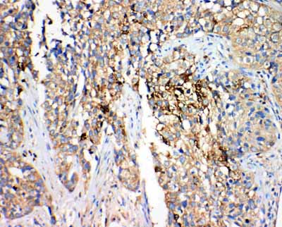 2 - Anti-Hydroxysteroid(17-Beta) Dehydrogenase 4 Antibody ABO11036