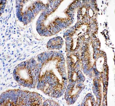 2 - Anti-Hydroxysteroid(17-Beta) Dehydrogenase 4 Antibody ABO11036