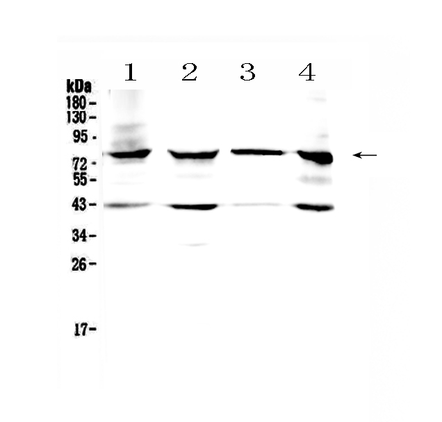1 - Anti-Hydroxysteroid(17-Beta) Dehydrogenase 4 Antibody ABO11036