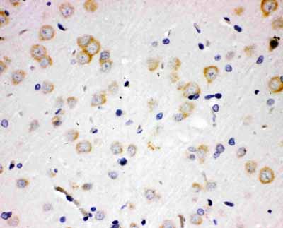 2 - Anti-PAK6 Antibody ABO11038