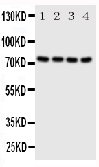 1 - Anti-PAK6 Antibody ABO11038