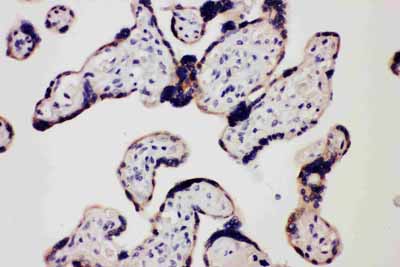 2 - Anti-TLR7 Antibody ABO11041