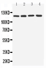 1 - Anti-TLR7 Antibody ABO11041