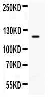 1 - Anti-TLR8 Antibody ABO11042