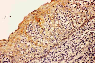 2 - Anti-Caspase-8 (p18) Antibody ABO11043