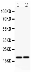 1 - Anti-Caspase-8 (p18) Antibody ABO11043