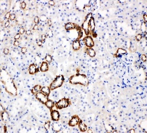2 - Anti-SLC2A5 Antibody ABO11045