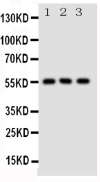 1 - Anti-SLC2A5 Antibody ABO11045