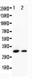 1 - Anti-Granzyme B Antibody ABO11046