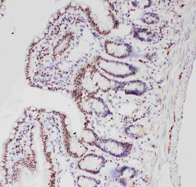 2 - Anti-ALK Antibody ABO11049
