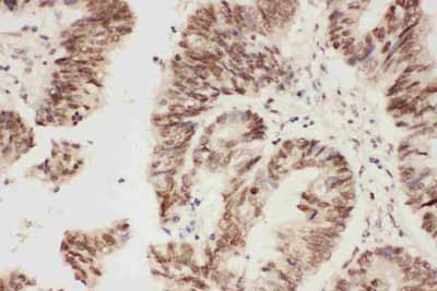 2 - Anti-ALK Antibody ABO11049