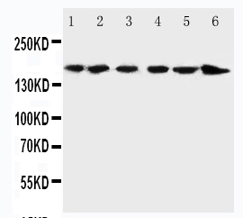 1 - Anti-ALK Antibody ABO11049