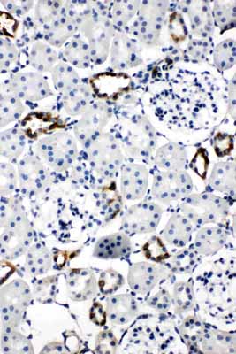 2 - Anti-Aquaporin 2 Antibody ABO11050