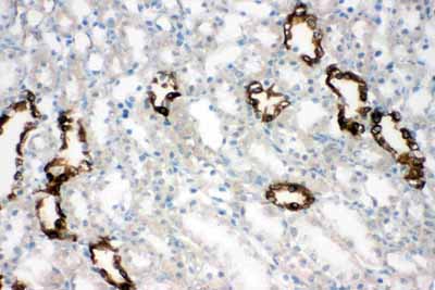 2 - Anti-Aquaporin 2 Antibody ABO11050