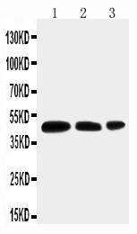 1 - Anti-Aquaporin 2 Antibody ABO11050