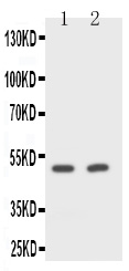 1 - Anti-CD2 Antibody ABO11051