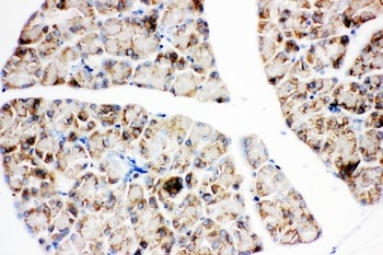 2 - Anti-IGF1R Antibody ABO11055