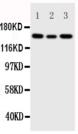 1 - Anti-IGF1R Antibody ABO11055
