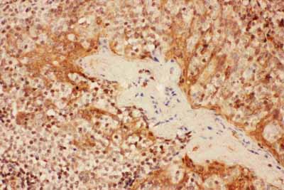 2 - Anti-CD25/IL-2sR alpha Antibody ABO11056