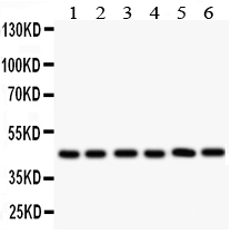 1 - Anti-CD25/IL-2sR alpha Antibody ABO11056