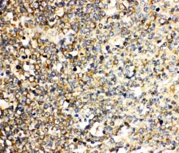 2 - Anti-IL-3 Antibody ABO11057