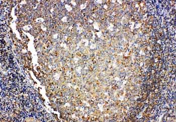 2 - Anti-IL-4 Antibody ABO11058