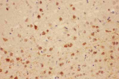 2 - Anti-MAG Antibody ABO11060