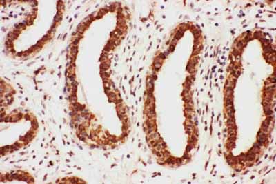 2 - Anti-MAG Antibody ABO11060