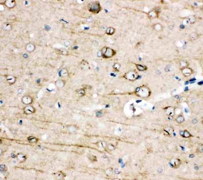 2 - Anti-TRPC3 Antibody ABO11063