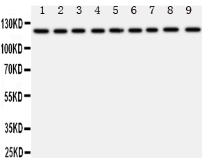 1 - Anti-TRPC3 Antibody ABO11063