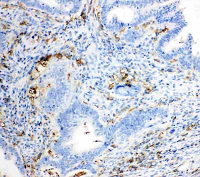 2 - Anti-TRPC6 Antibody ABO11064