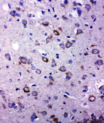 2 - Anti-TRPC6 Antibody ABO11064
