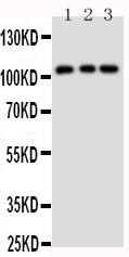 1 - Anti-TRPC6 Antibody ABO11064